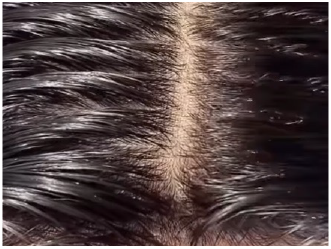 分け目もバレない