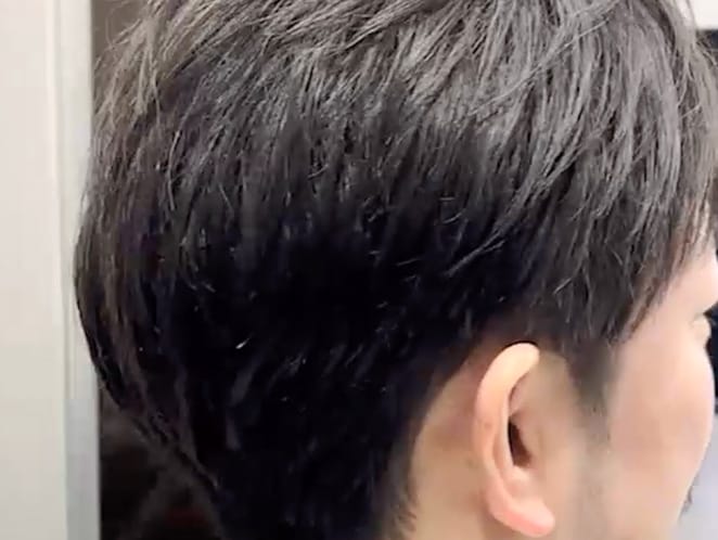 自毛に馴染んでバレない